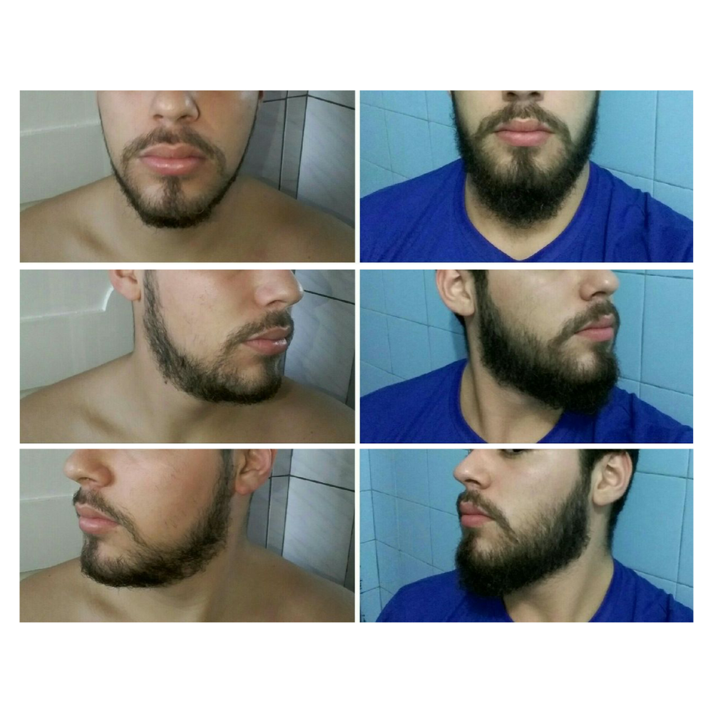 KIRKLAND MINOXIDIL LOÇÃO ANTIQUEDA 60ML